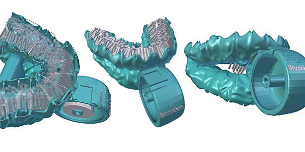 Blizzident: сумасшедшая 3D-печатная щетка для ваших зубов Blizzident